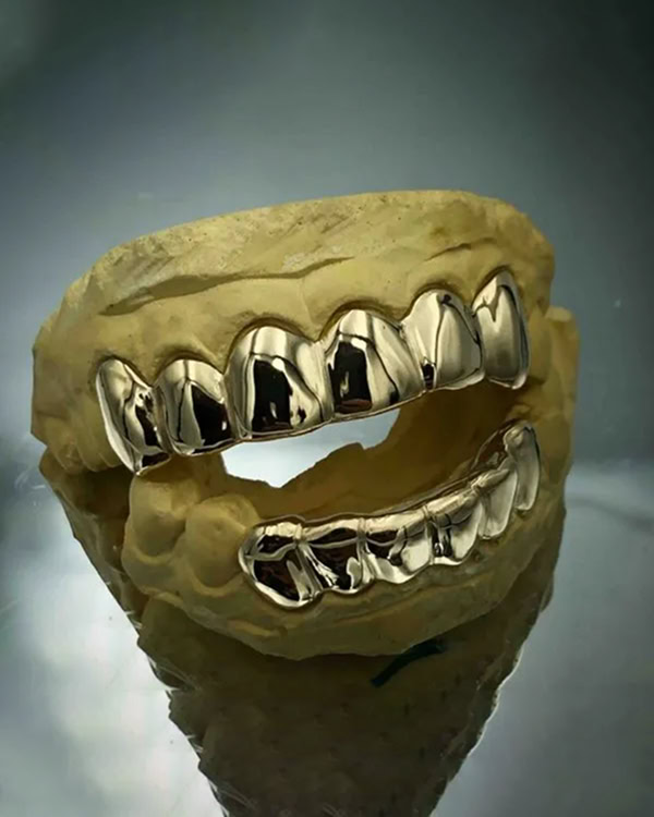 10K Gold Six Piece